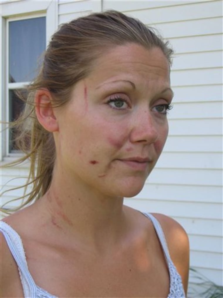 This June 27, 2009 photo provided by the Calumet County Sheriff's Department shows Stephanie Van Groll, a domestic abuse victim whose ex-boyfriend Shannon Konitzer was charged with nearly choking her to death. A police report says Calumet County District Attorney Kenneth Kratz sent repeated text messages trying to spark an affair with Van Groll while he was prosecuting her ex-boyfriend. (AP Photo/Calumet County Sheriff's Department)